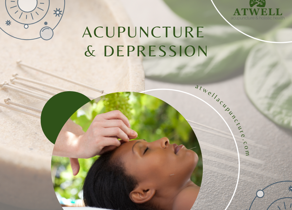 Acupuncture & Depression
